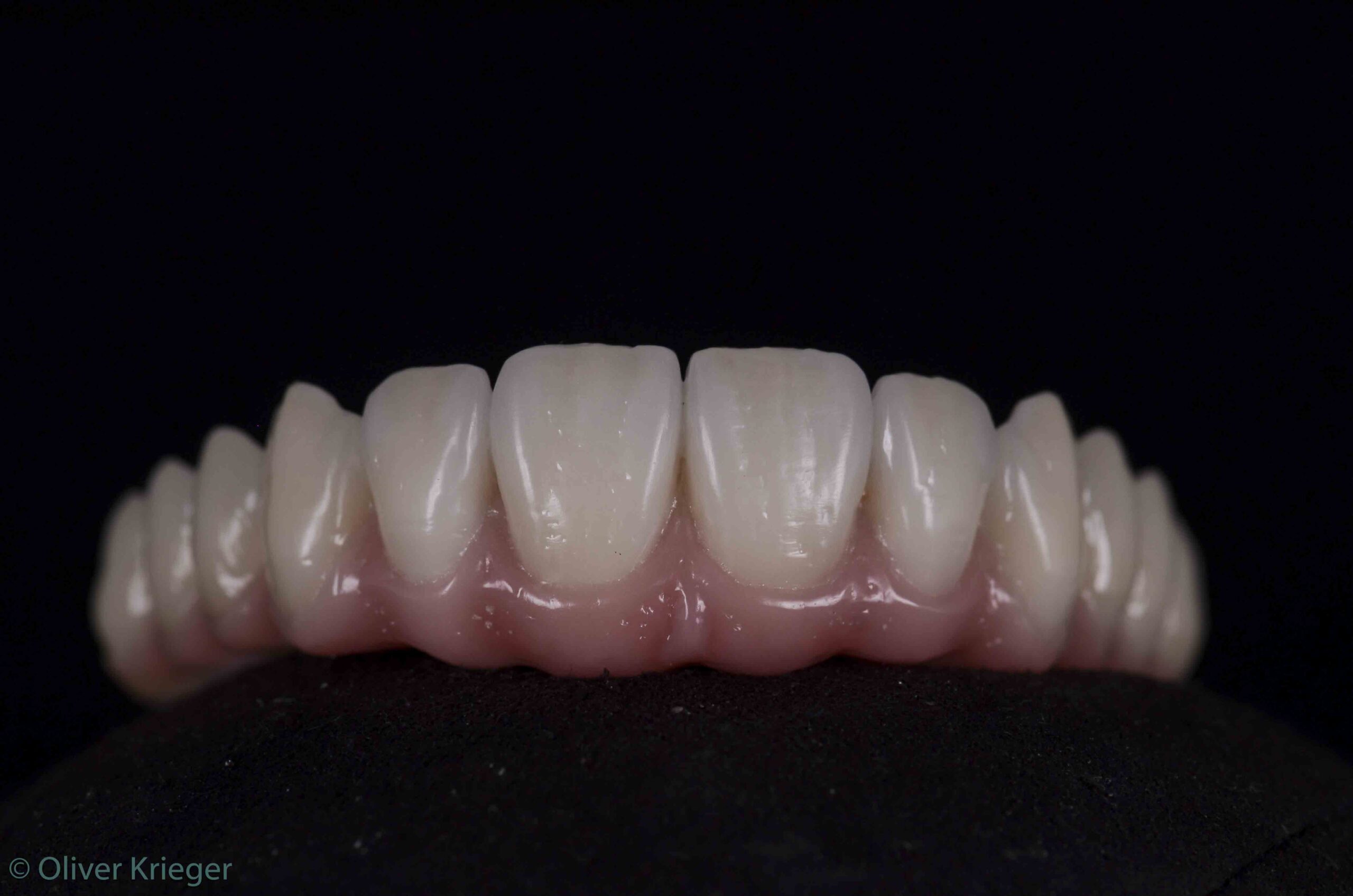 Implantate Case 02